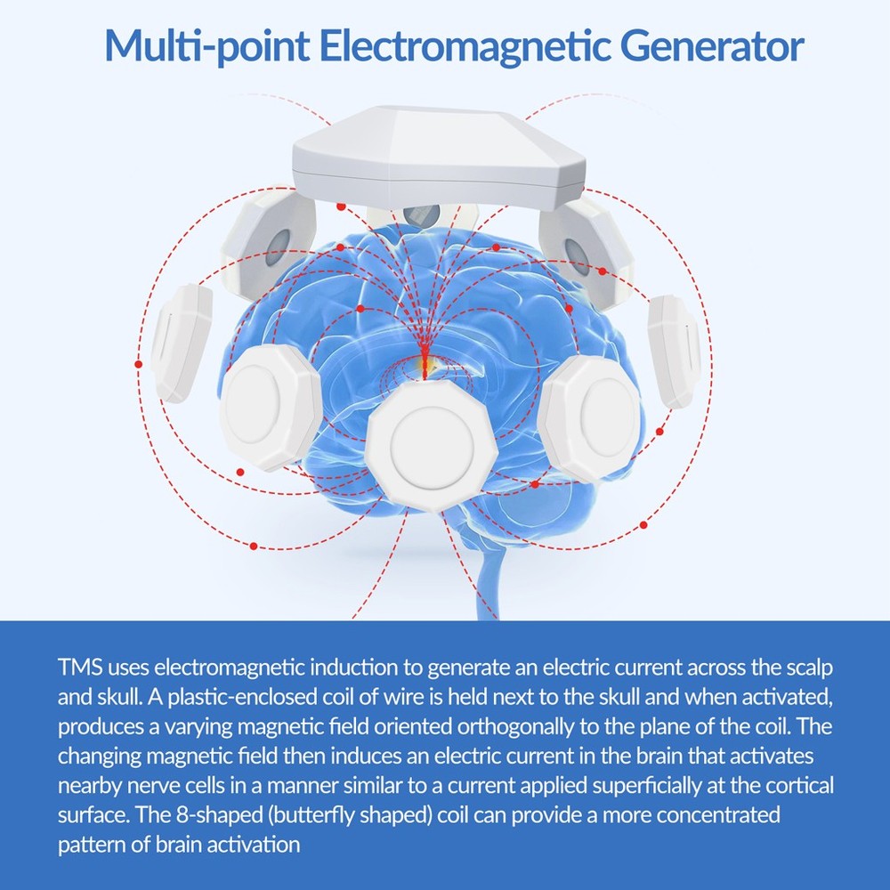 rTMS Brain Therapy Deep Brain Stimulator Machine Anxiety Migraine Depression
