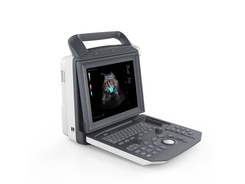 portable ultrasound machine