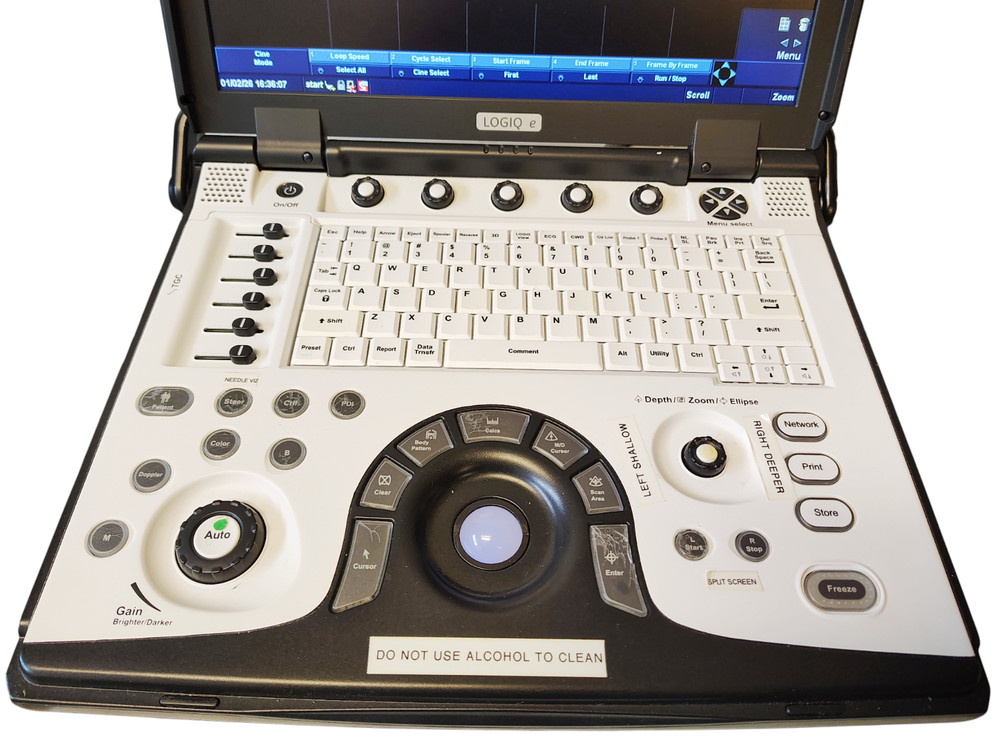 GE LOGIQ E Ultrasound System