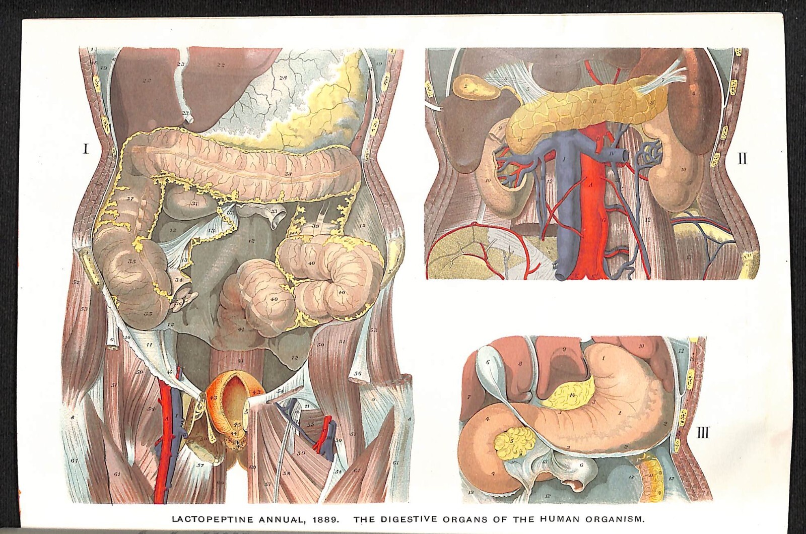New York Pharmacal Association "Lactopeptine Medical Annual" 1889 32pp Scarce