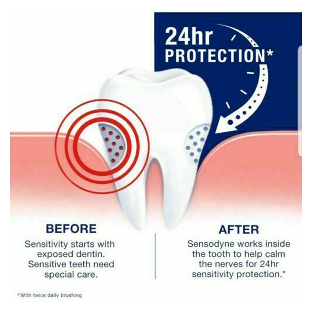 Sensodyne Fluoride Toothpaste ORIGINAL Plus 100g x 4EA * Help to reduce plaque*