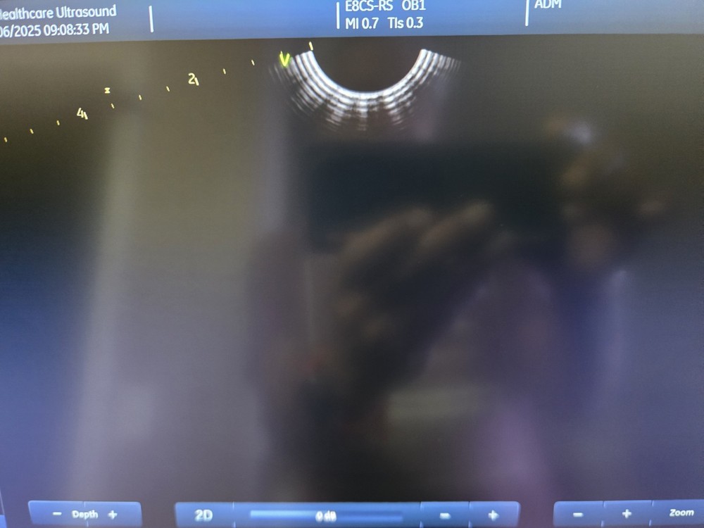 GE E8Cs-RS Ultrasound Probe / Transducer