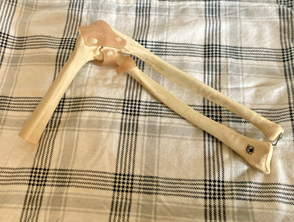 Somso Anatomical Elbow Joint Model. Read