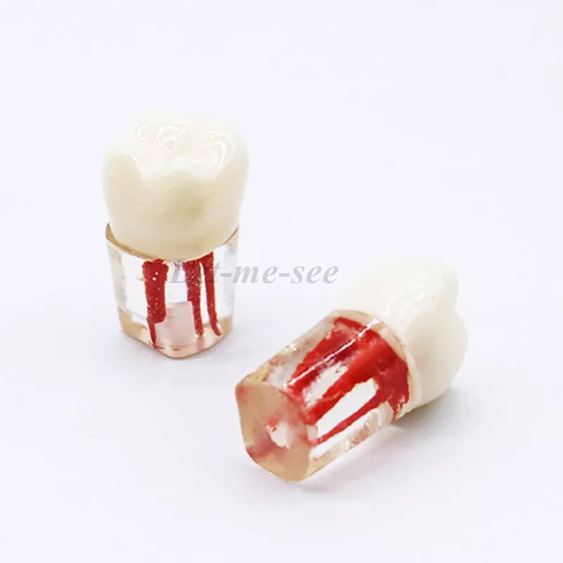 Dental Root Canal Pulp Cavity Practice Teeth Model RCT Endodontic Practice