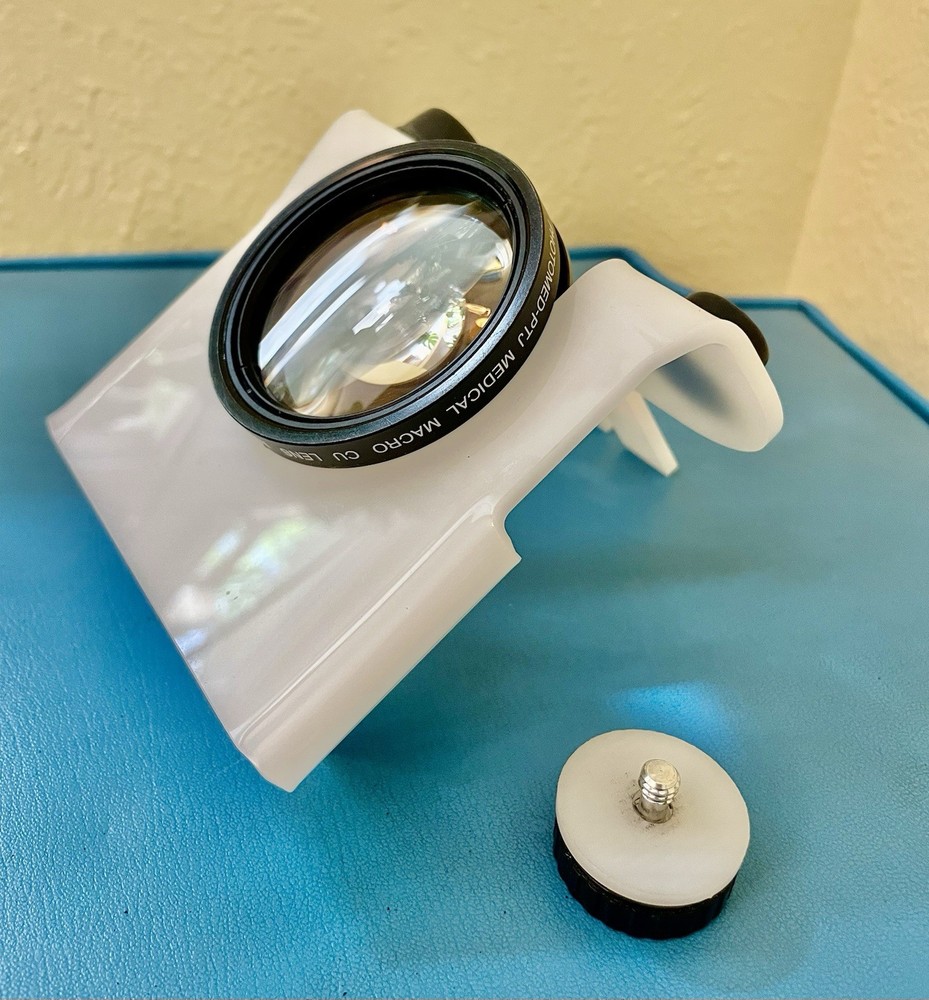PhotoMed Camera Attachment D