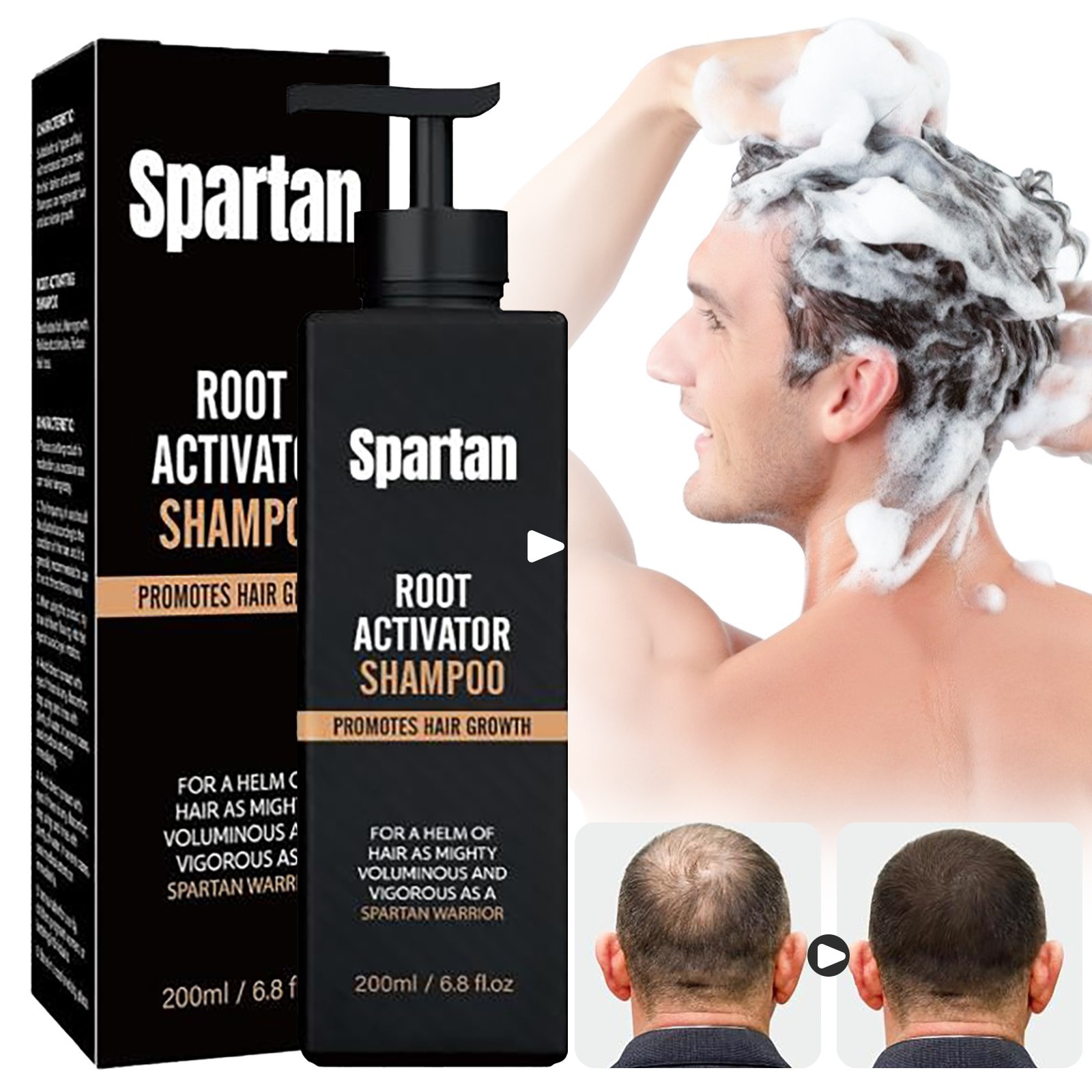 Root Activator Shampoo SPARTAN Hair Loss Shampoo Root Activator ( 200ml )