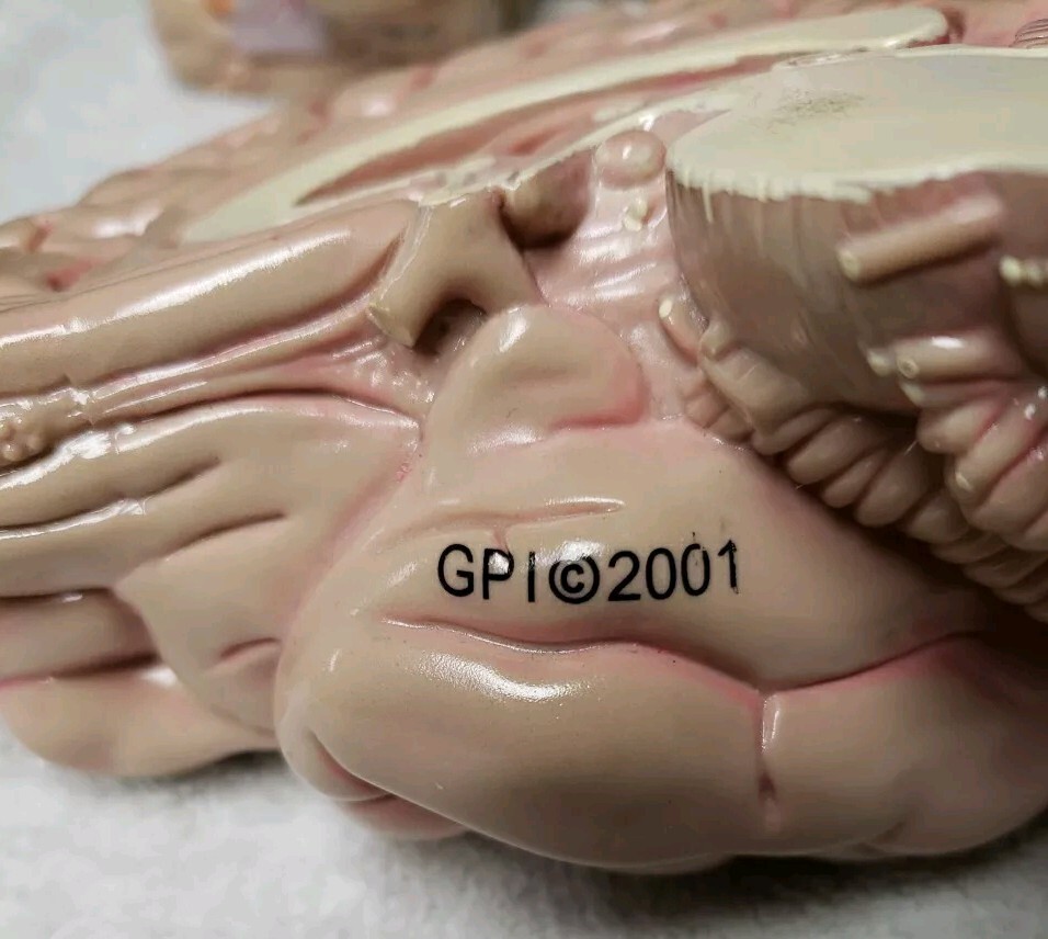 GPI Brain/ Partial Skull Model