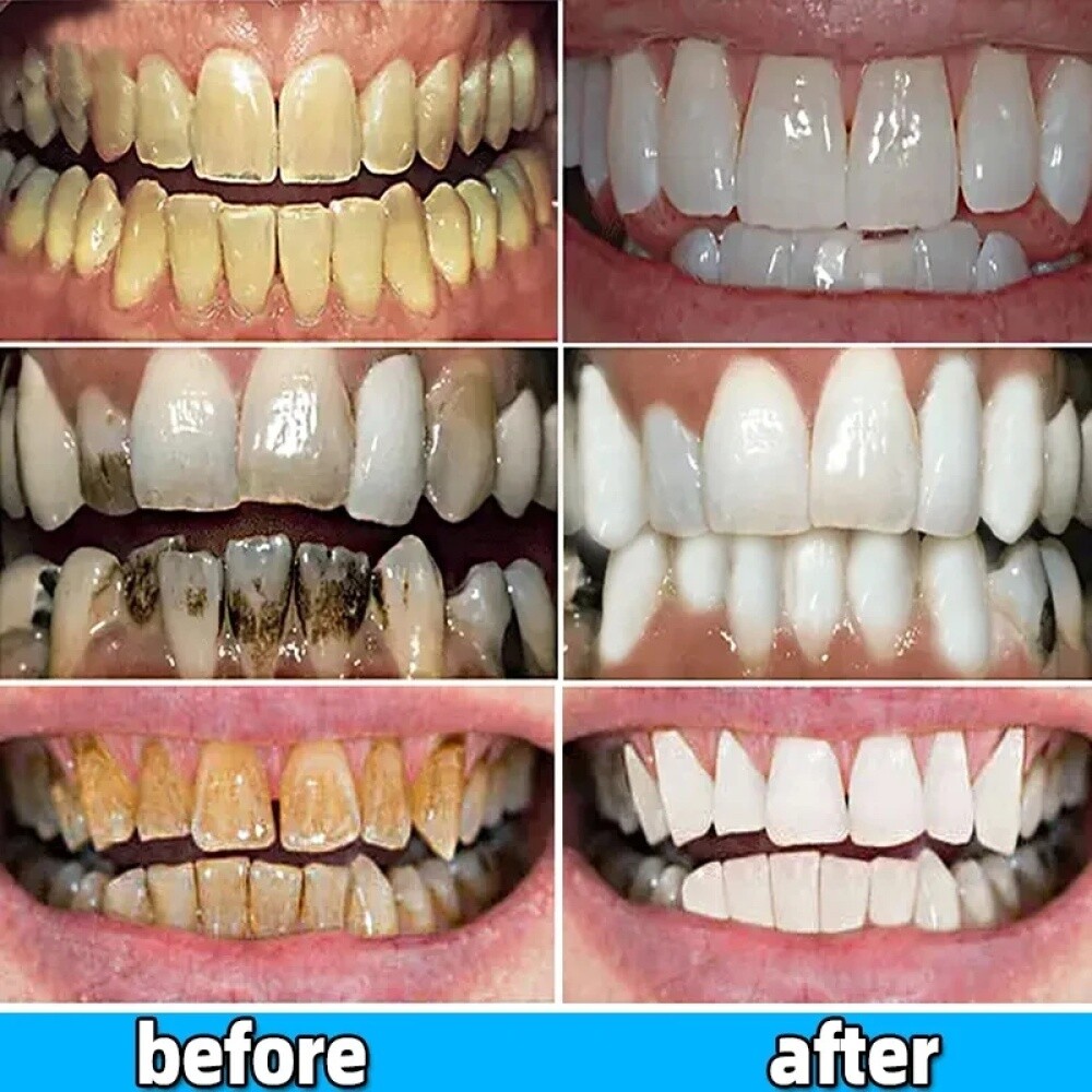 Sip-4 Toothpaste, Whitening Sp-4 Toothpaste, Sp-4 Probiotic Whitening Toothpaste