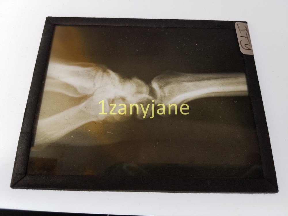 ITY HISTORIC Magic Lantern GLASS Slide BONE JOINT