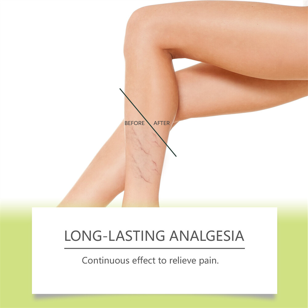 Senzio-Miracle Balm,New Soothing Joint Cream for Back, Hands,Feet and Body