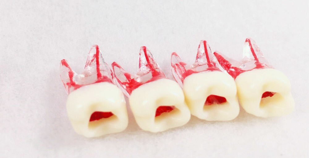 Dental Tooth Endo Root Canal Study Model For RCT Practice Blocks Pulp Cavity