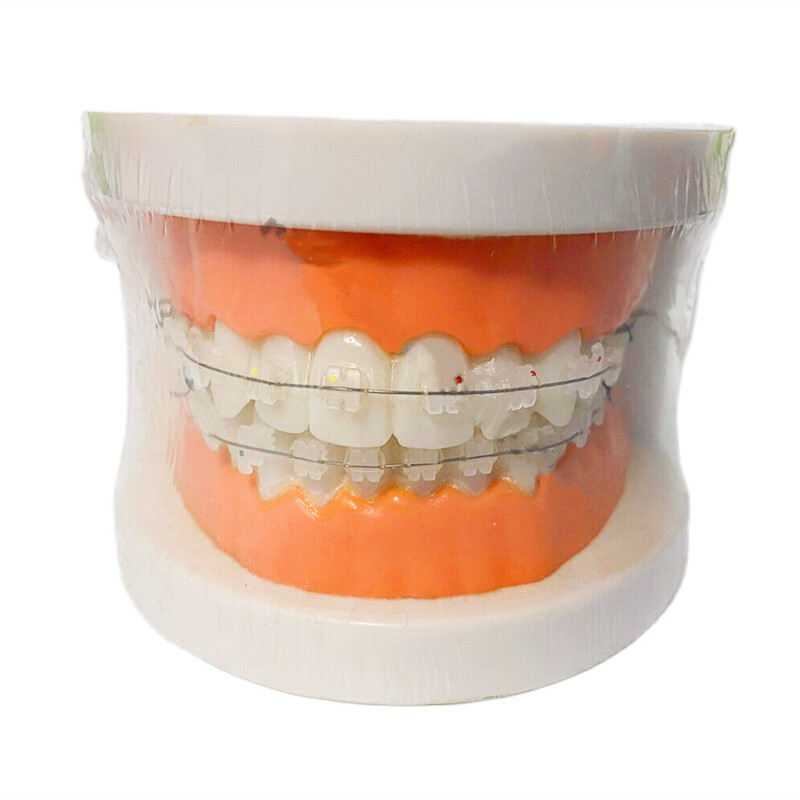 Dental All Ceramic Brackets Study Model Retainer Clear Bracket Orthodontic Model