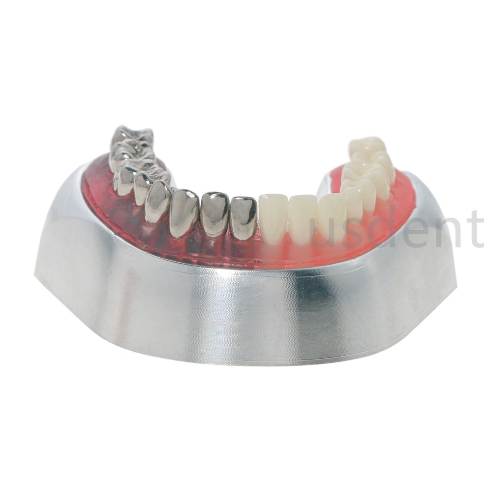 Dental Teeth Model With Restoration Learning and Teaching Demonstrate M6004