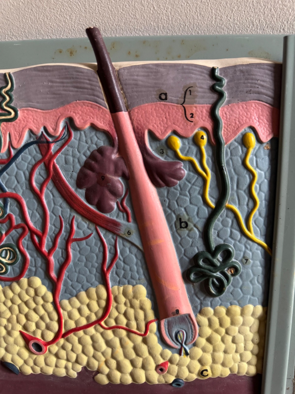 Vintage anatomical model of SKIN Hair follicle & sweat glands