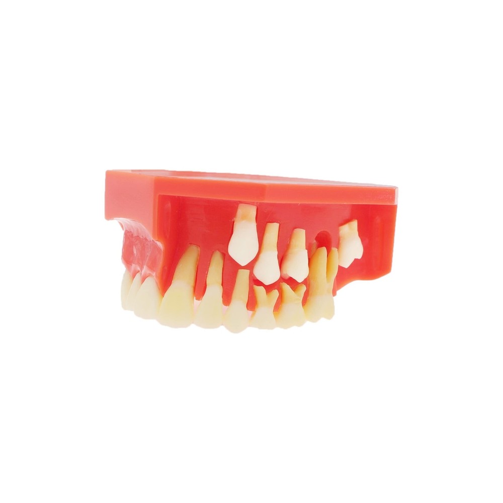 Teeth Typodonts Dental Model #7013 - Teeth Eruption Development Model Alterna...