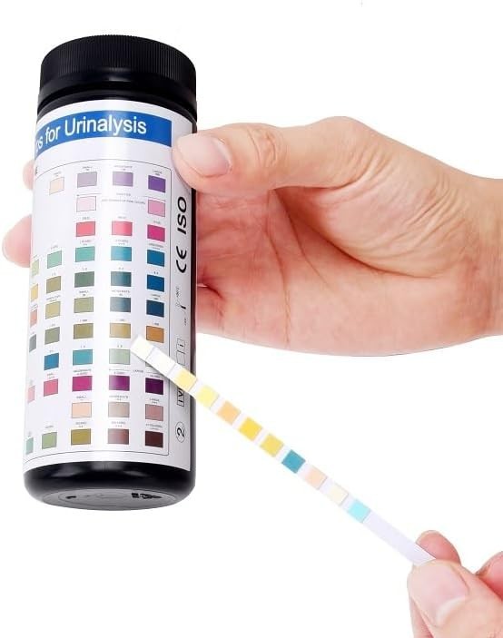 Rapid Strips 11 Parameters - UTI & Liver Function Kit