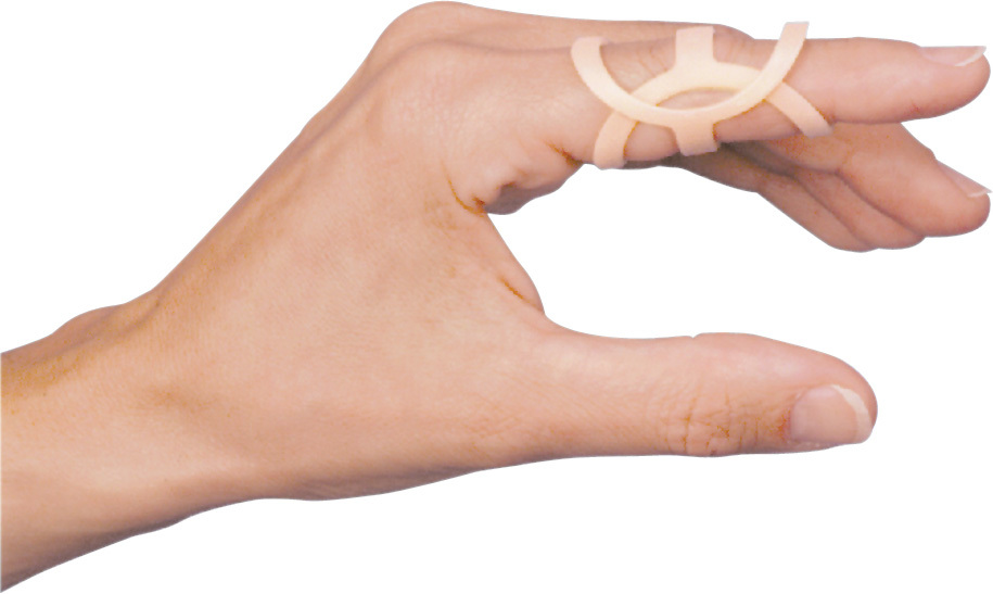 3pp Oval-8 Finger Splints (5 Pack Refill Kit)