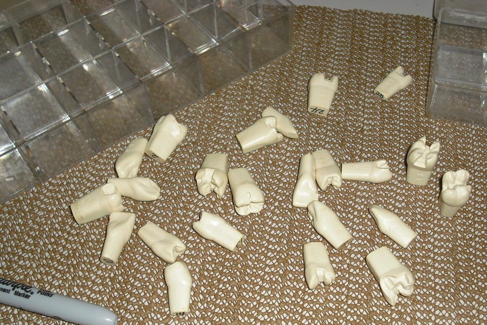 Dental Teeth Preparations for Students and Practicioners - Assorted Preps