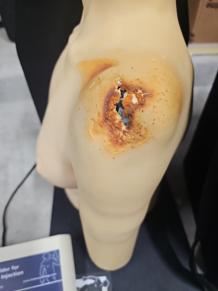 30010 Limbs & Things Shoulder for Joint Injection Training Trainer Simulator