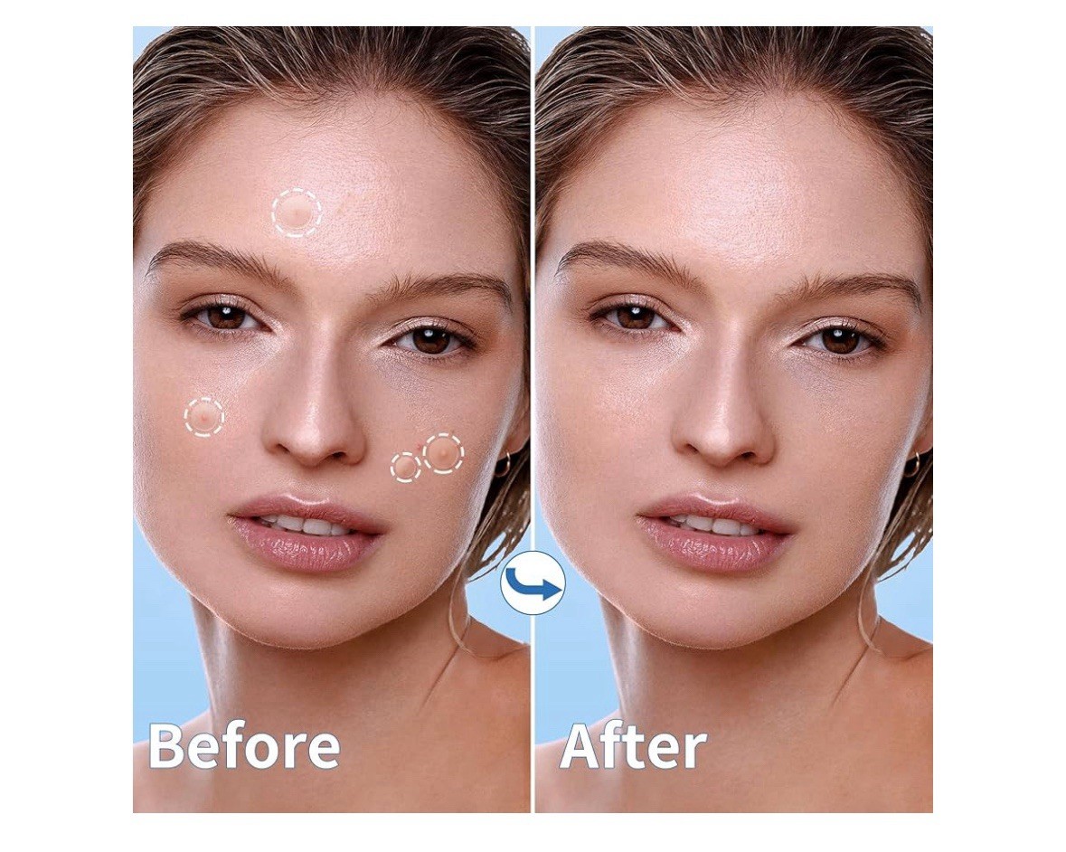 Pimple Patches for Face, 4 Size 300 Counts Acne Patches