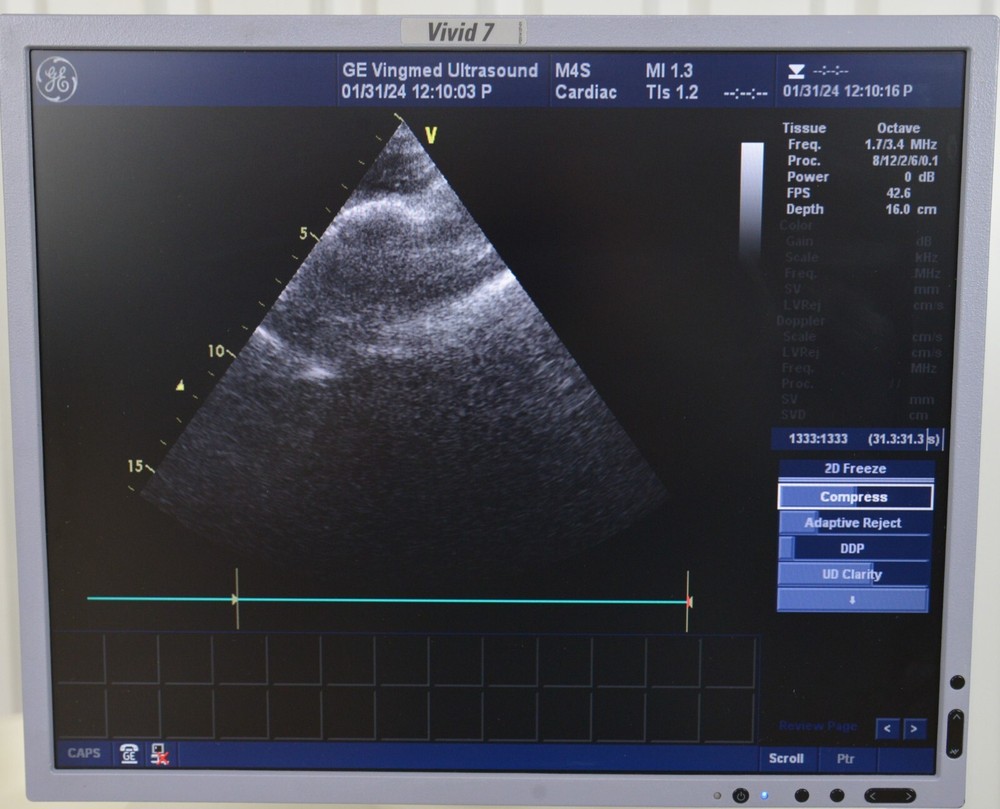 GE M4S Cardiac Sector Array 5129041