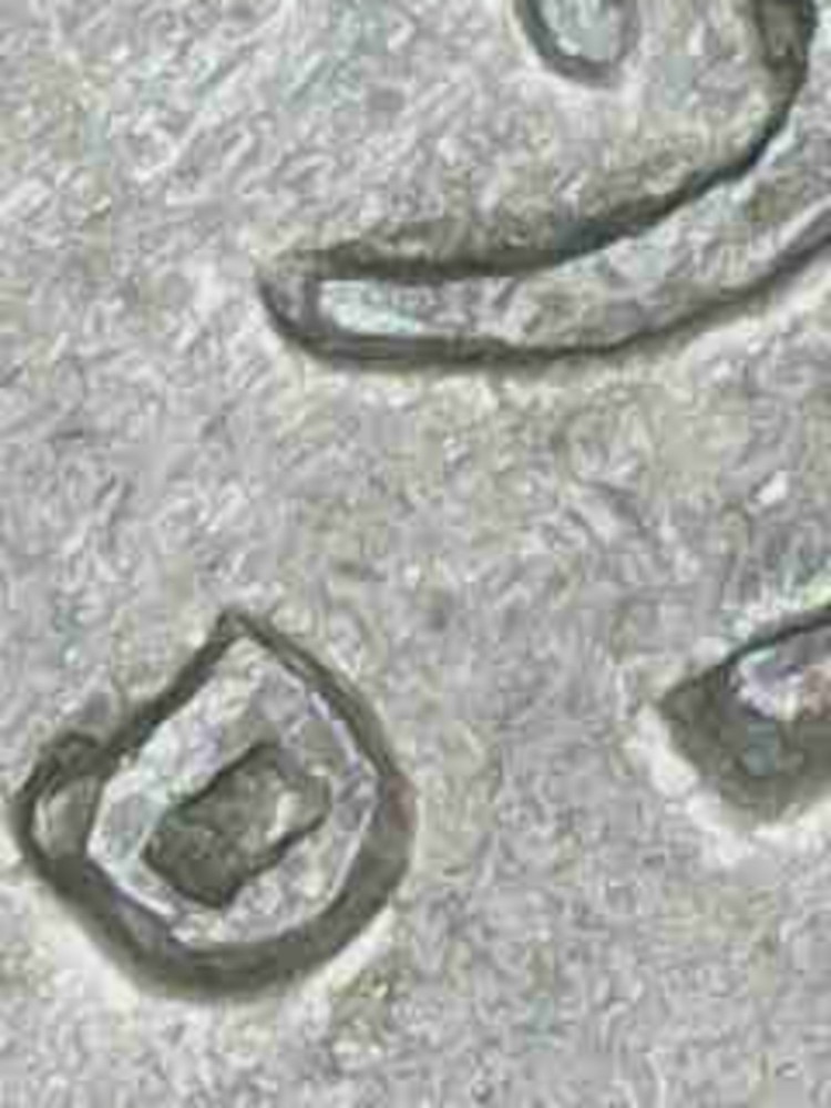 1971D Lincoln 1-CENT with RPM, DDO Errors & Die Chips Error!