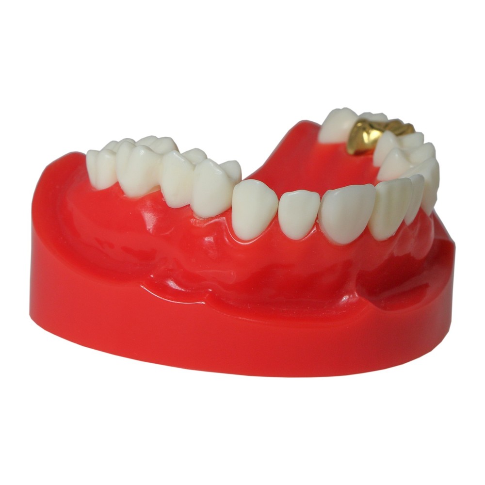 Dental M6004 Teaching Typodont Restoration Teeth Model Crown Post Core Bridge