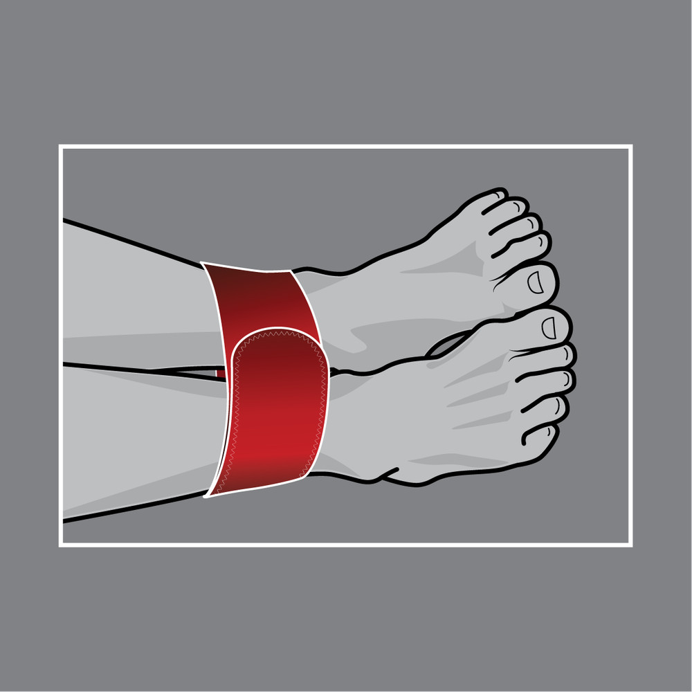 Pelvic Binder, Gen 2