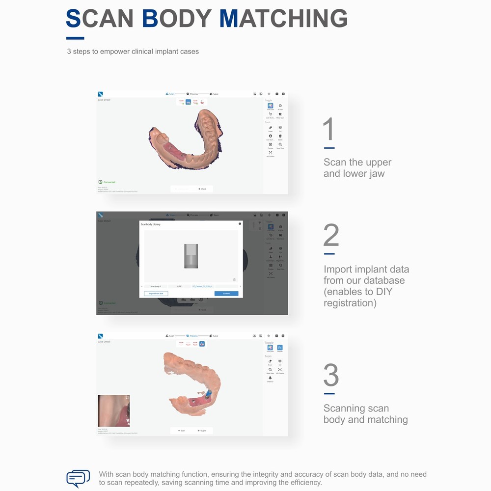 Dental 3D Scanner 3D Printing with Scanning Software