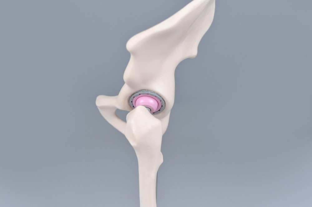 1/3 Artificial Hip Joint Replacement Anatomical Skeleton Demo Display Model