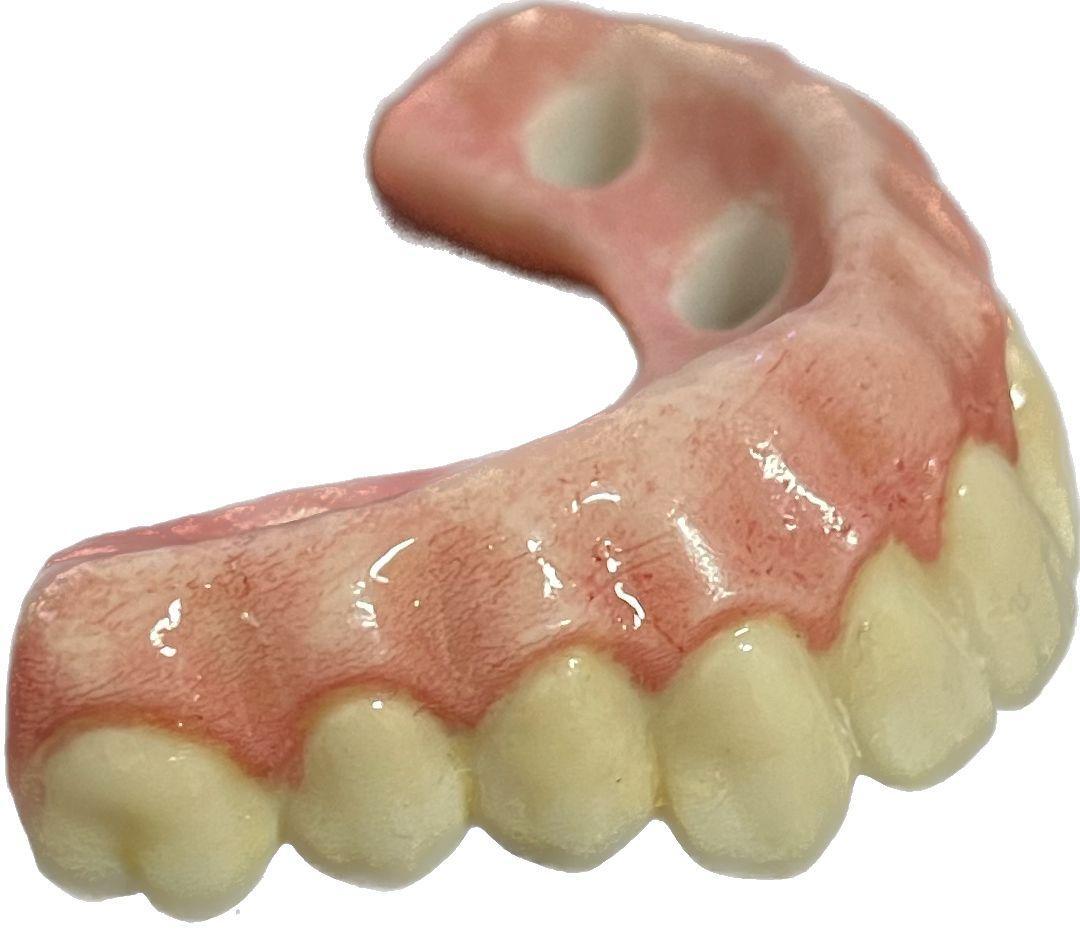 DLP SLA LCD 3d printer ALL ON X resin - for all on x cases, bridges,arcs, hybrid