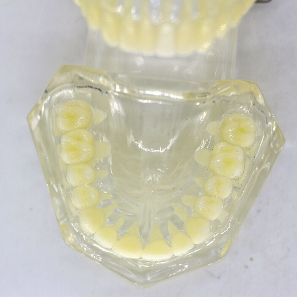 1×Yellow Transparent Plastic Study Teeth Model Demonstrate Comprehensive Repair
