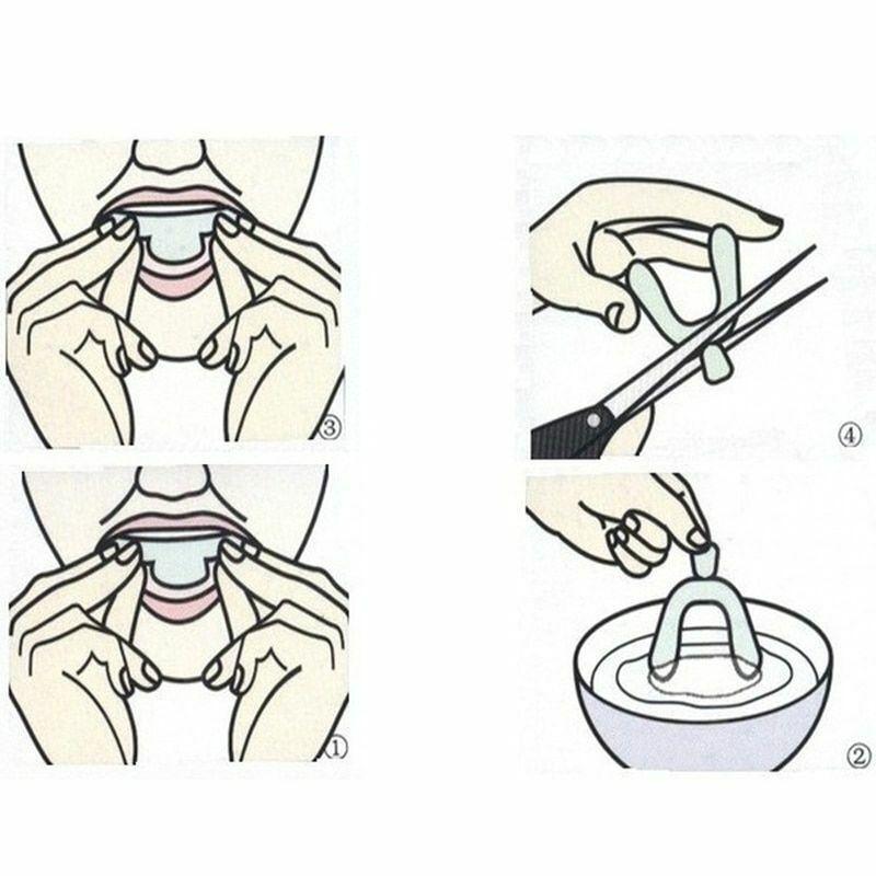 Orthodontic Retainer Fixed Corrector Teeth Retainers Thermoforming 2 Pairs Clear
