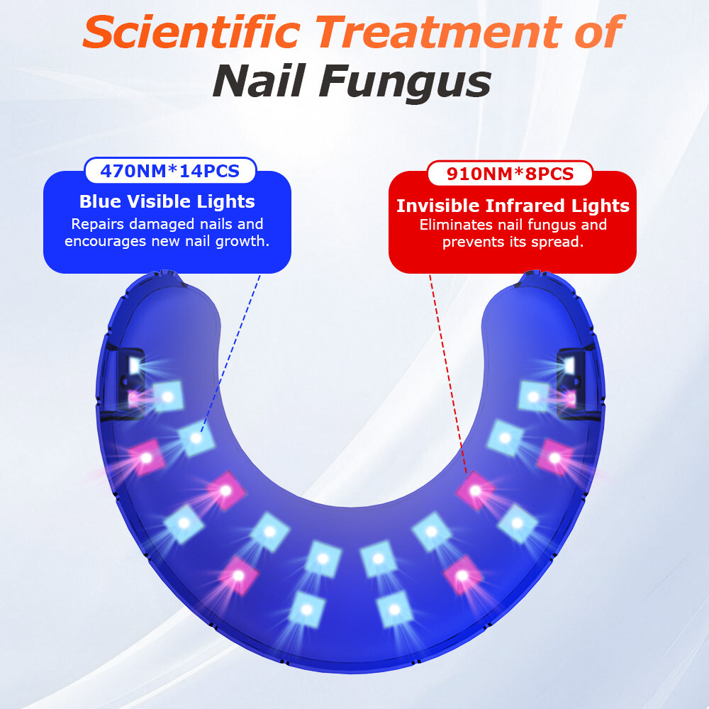 Toenail Fungus Laser Device Nail Repair Solution Toenail Fungus Laser Device