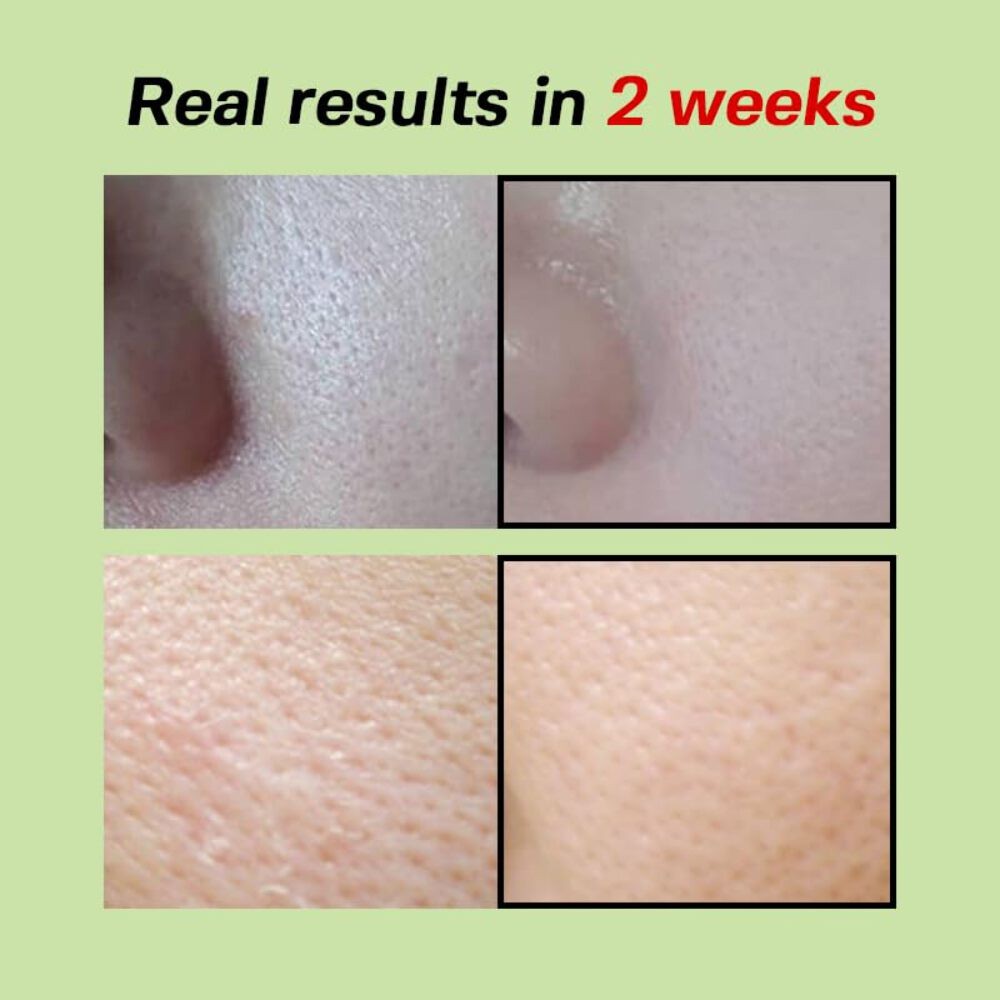 [ SUNGBOON EDITOR ] Green Tomato Pore Lifting Ampoule+ 30ml/1.01fl.oz