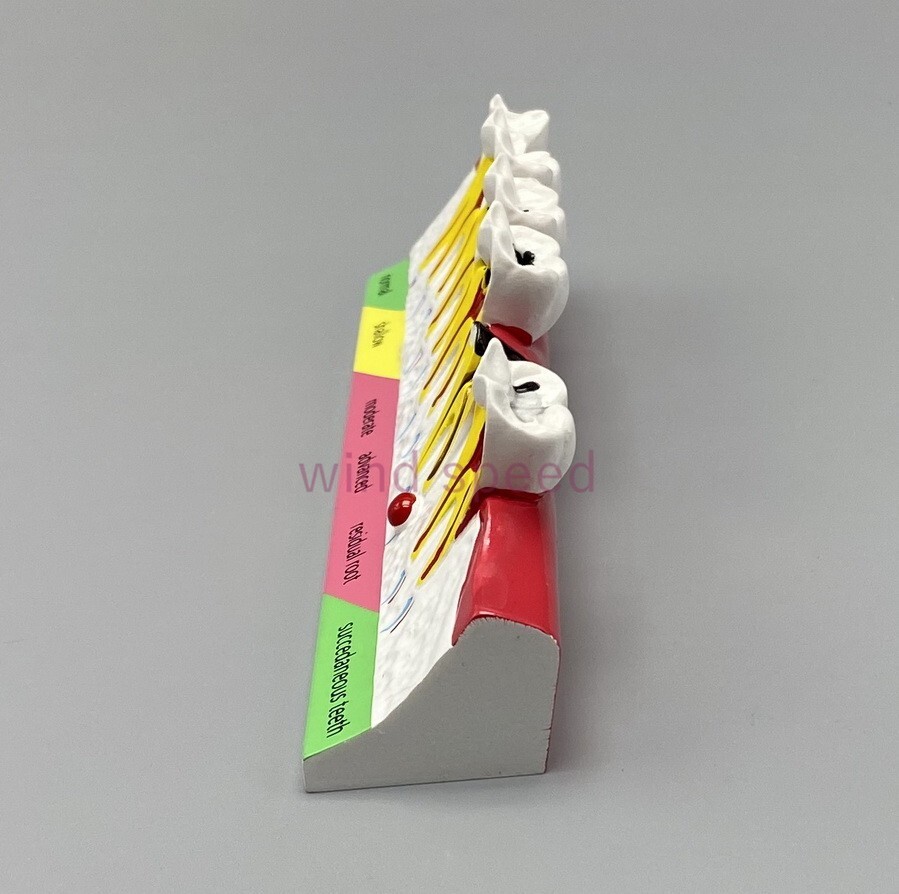 Dental lab Study Teaching Models Caries Disease Assort Teeth Dentoform Model