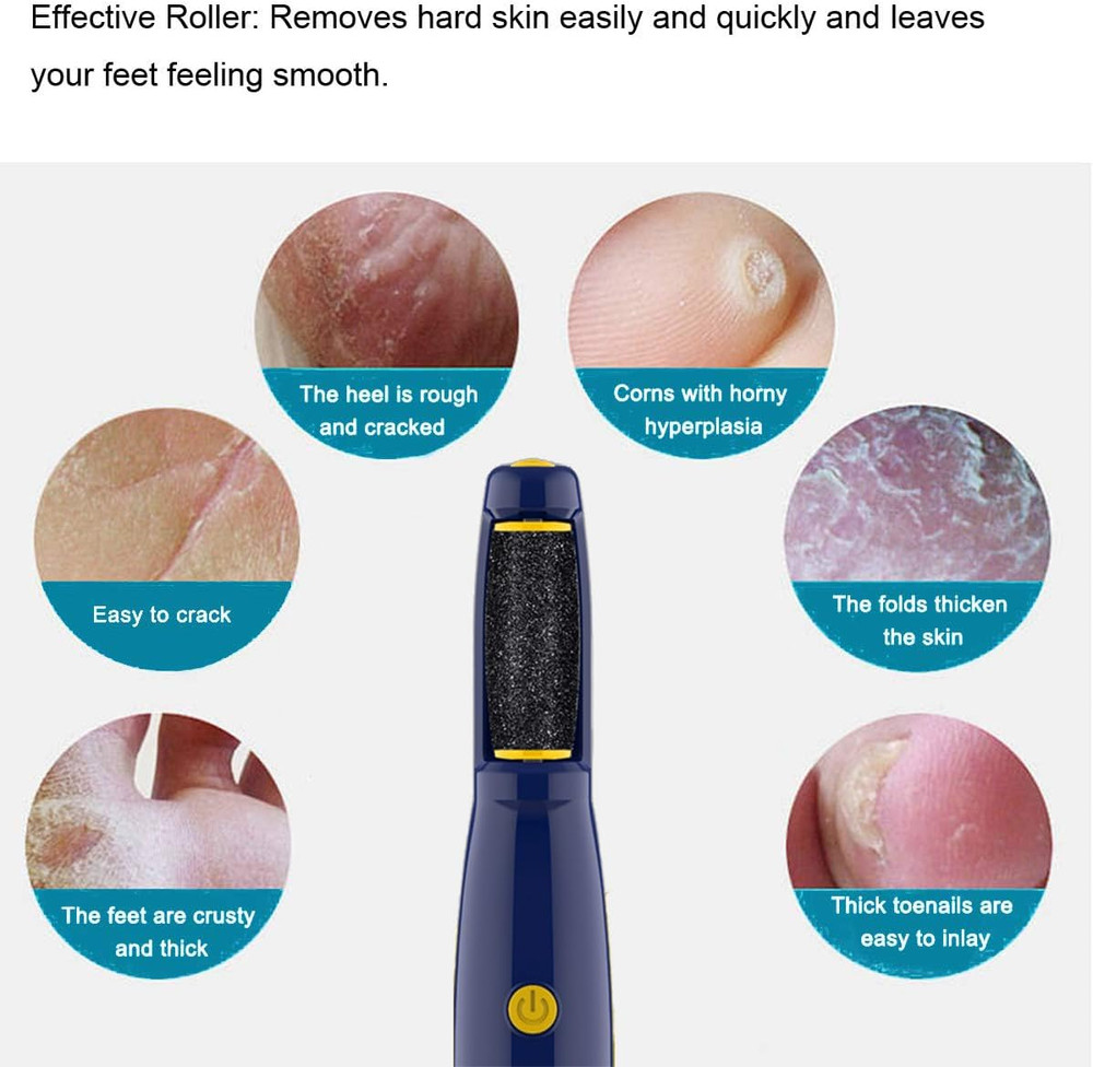 Roller Compatible with Dr. Scholl'S Remover Electronic Foot File-Extra Coarse...