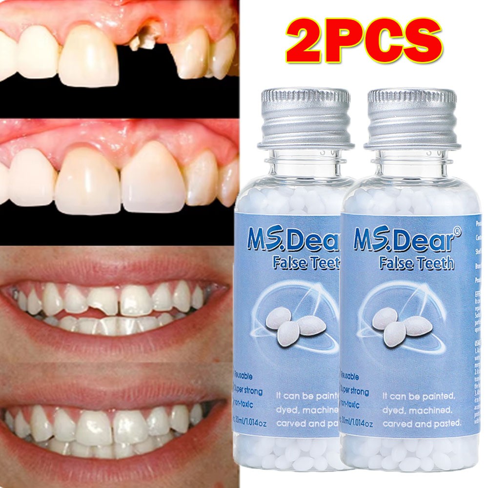 2X Tooth Repair Kit - Temporary Teeth Replacement Kit for Missing & Broken Teeth