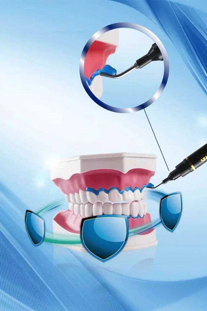 LaserGlow Light Cured Gingival Barrier - Teeth Whitening -