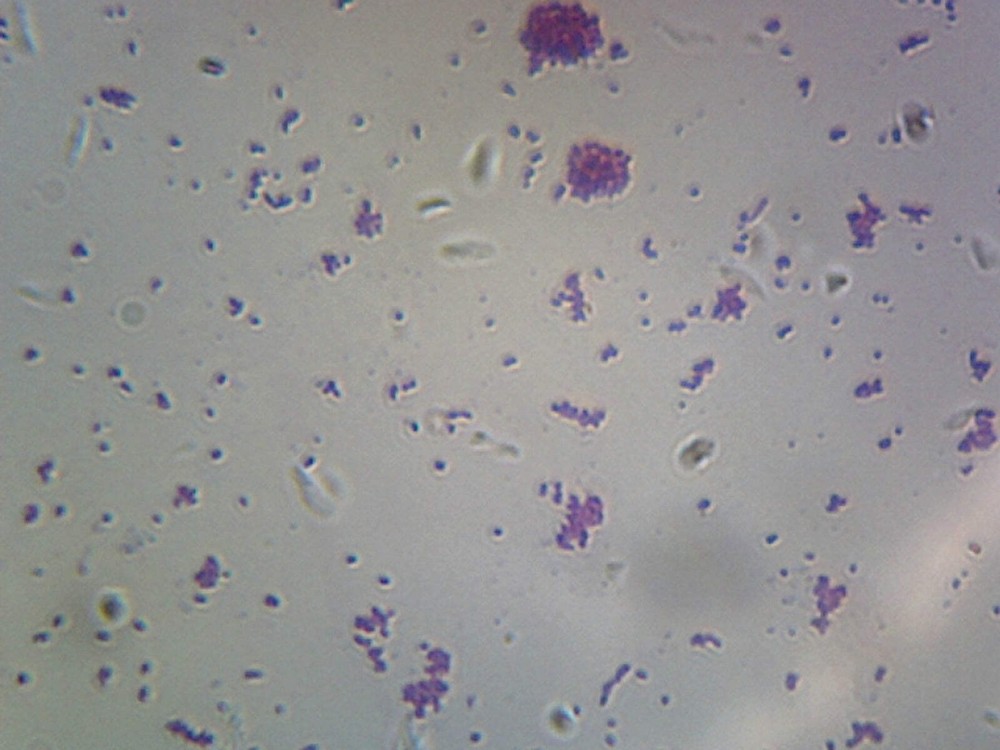 Coccus; Smear; Gram-Negative