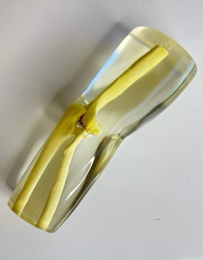 RSD Phantoms Natural Transparent Mannequin Elbow (Testing & Calibration)