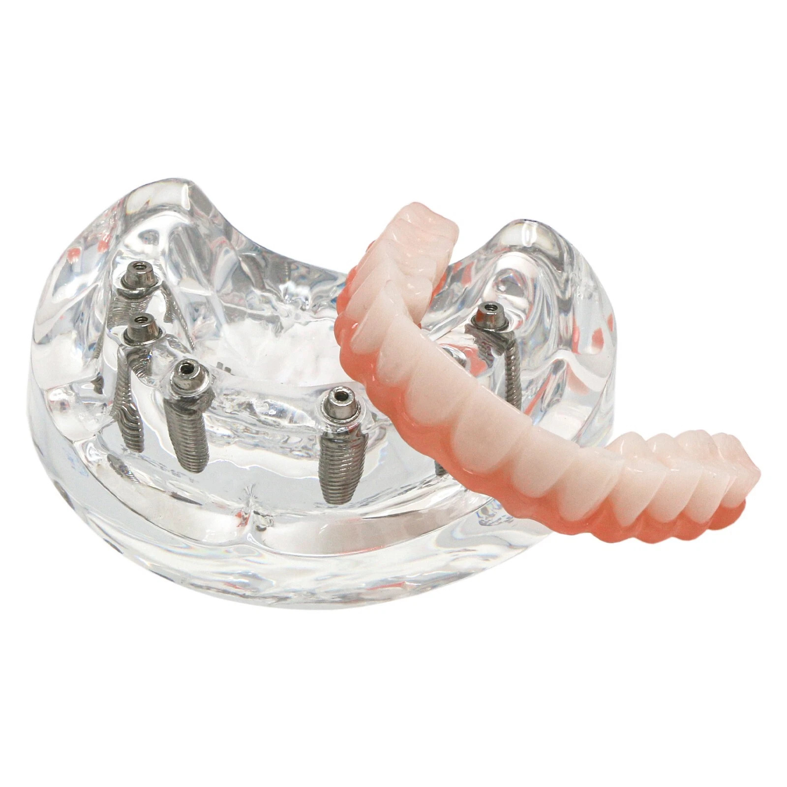 Dental Implant Restoration Model Upper Jaw 6 Screws Post Core Bridges M6001-2 US