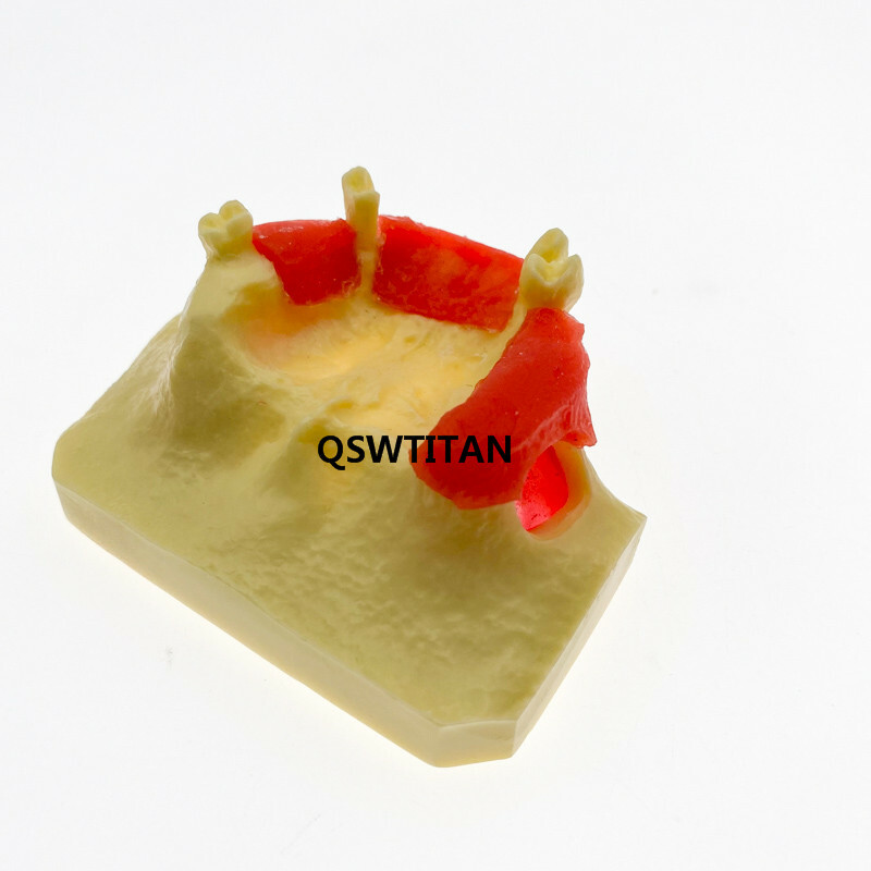 Dental Sinus Lift Practice Teeth Model Typodont Study Tooth Model M2012