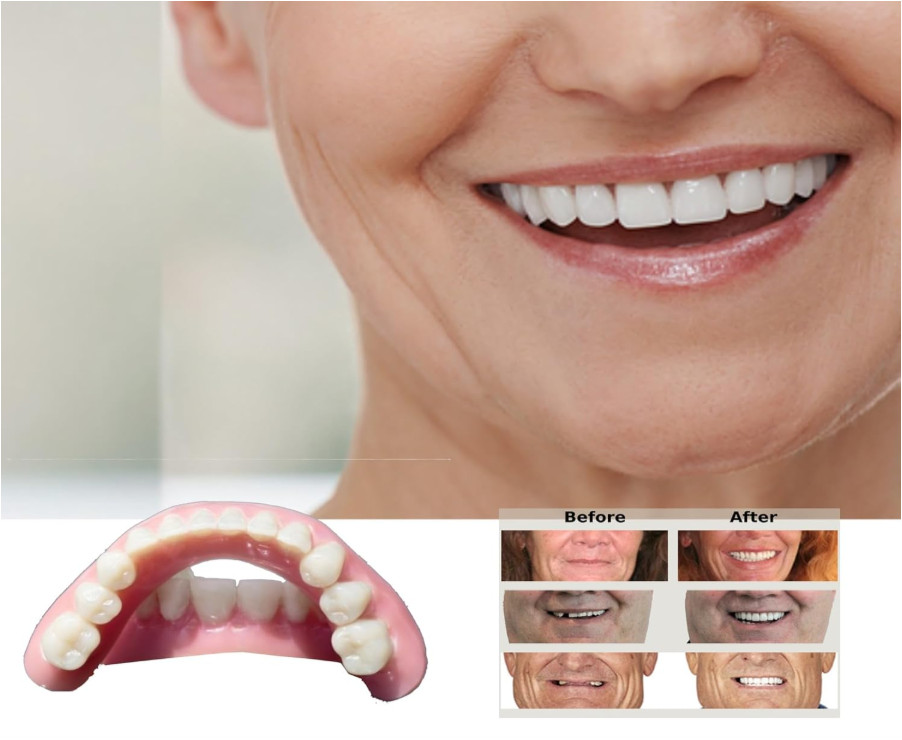DIY Denture Kit with Impression(2 Sets of False Teeth)Do-It-Yourself Denture...