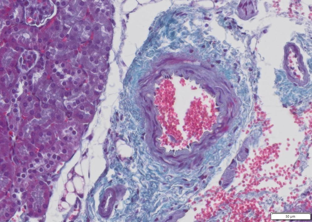 VitroView™ Modified Gomori’s Trichrome Stain Kit (Cat#VB-3014)