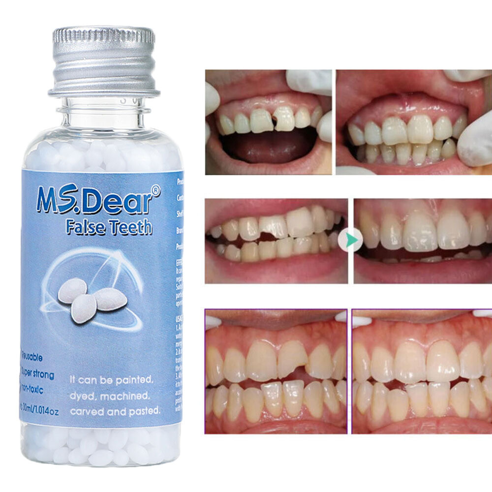 Temporary Tooth Repair Kit Temp Dental Repair Replace Missing Teeth DIY Moldable