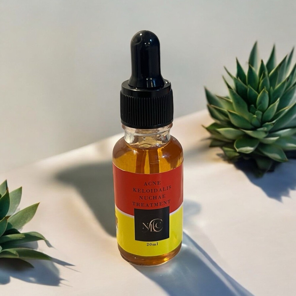 Acne Keloidalis Nuchae by NLC