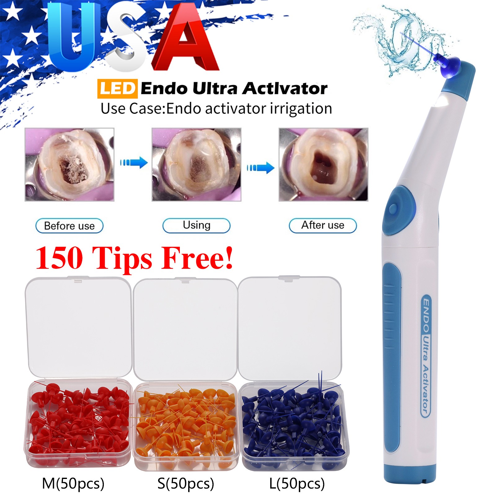 Dental LED Ultra sonic Endo Activator Endodontic Irrigator+150 Root Canal Tips