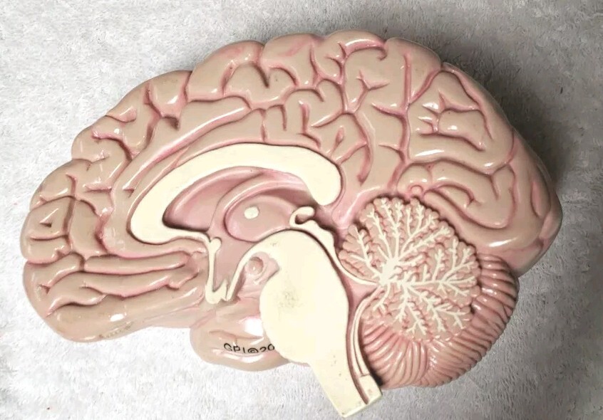GPI Brain/ Partial Skull Model