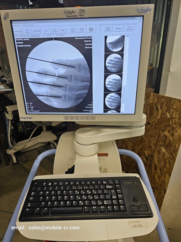 podiatry mini c-arm